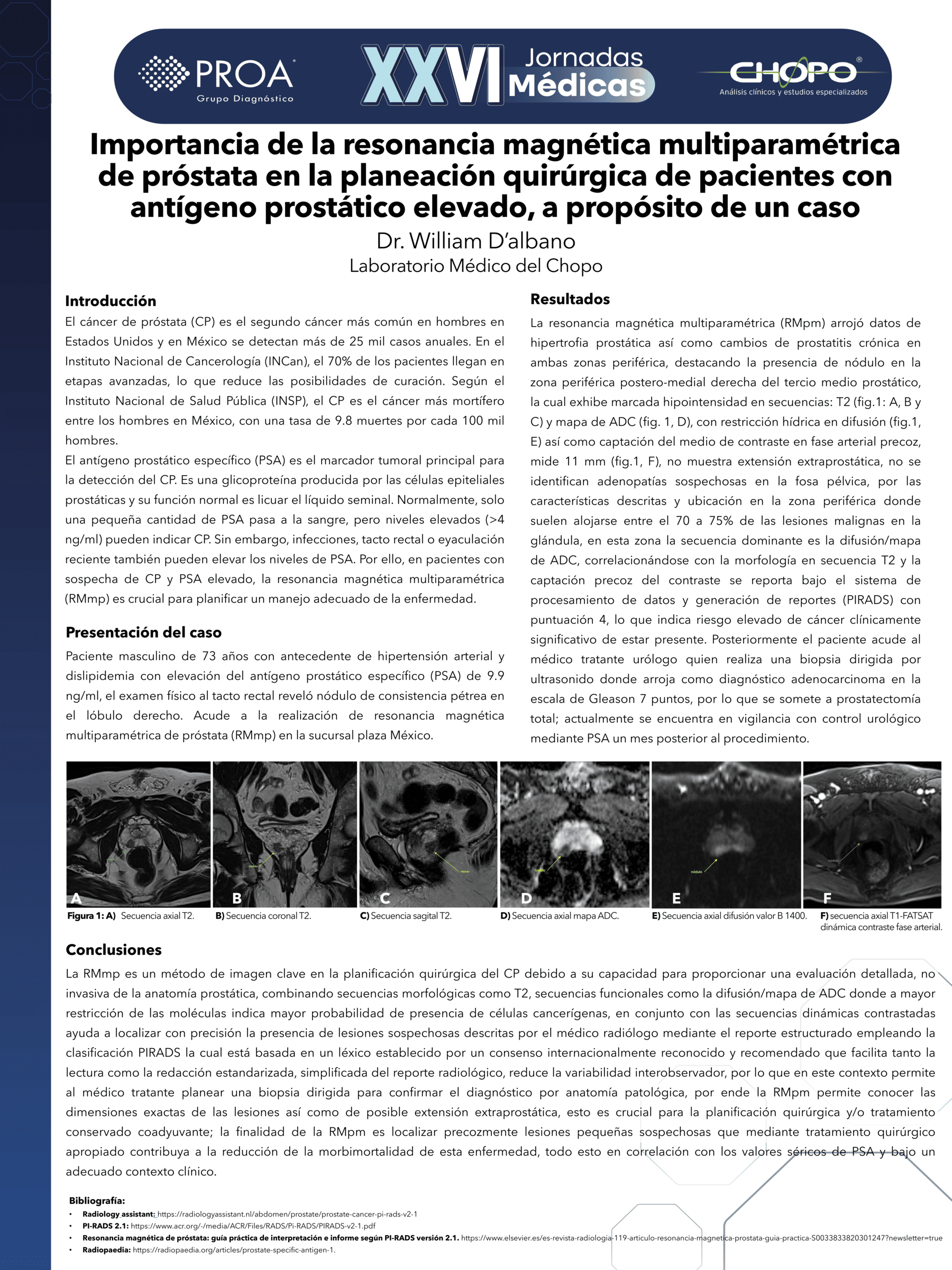 Importancia de la resonancia magnética multiparamétrica de próstata en la planeación quirúrgica de pacientes con antígeno prostático elevado, a propósito de un caso