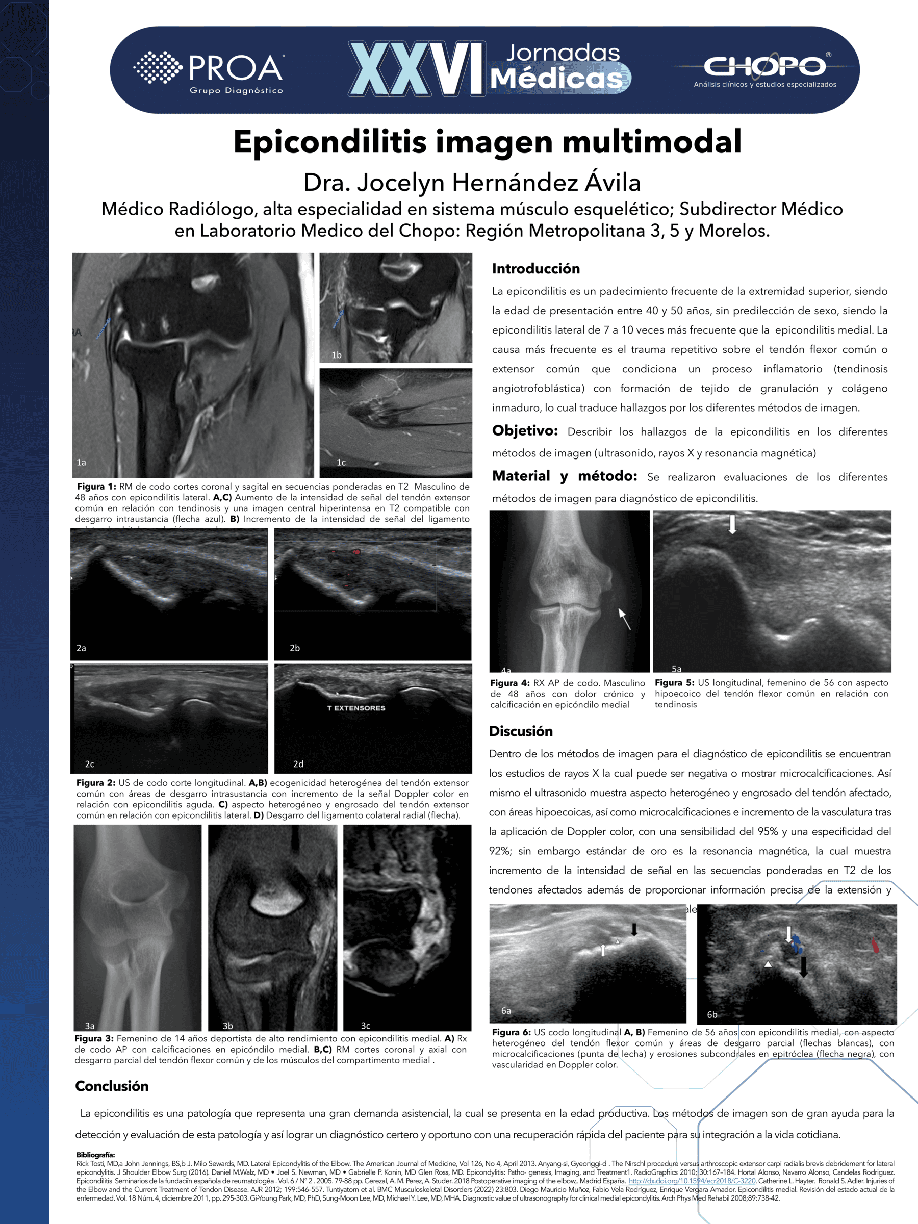 Epicondilitis imagen multimodal