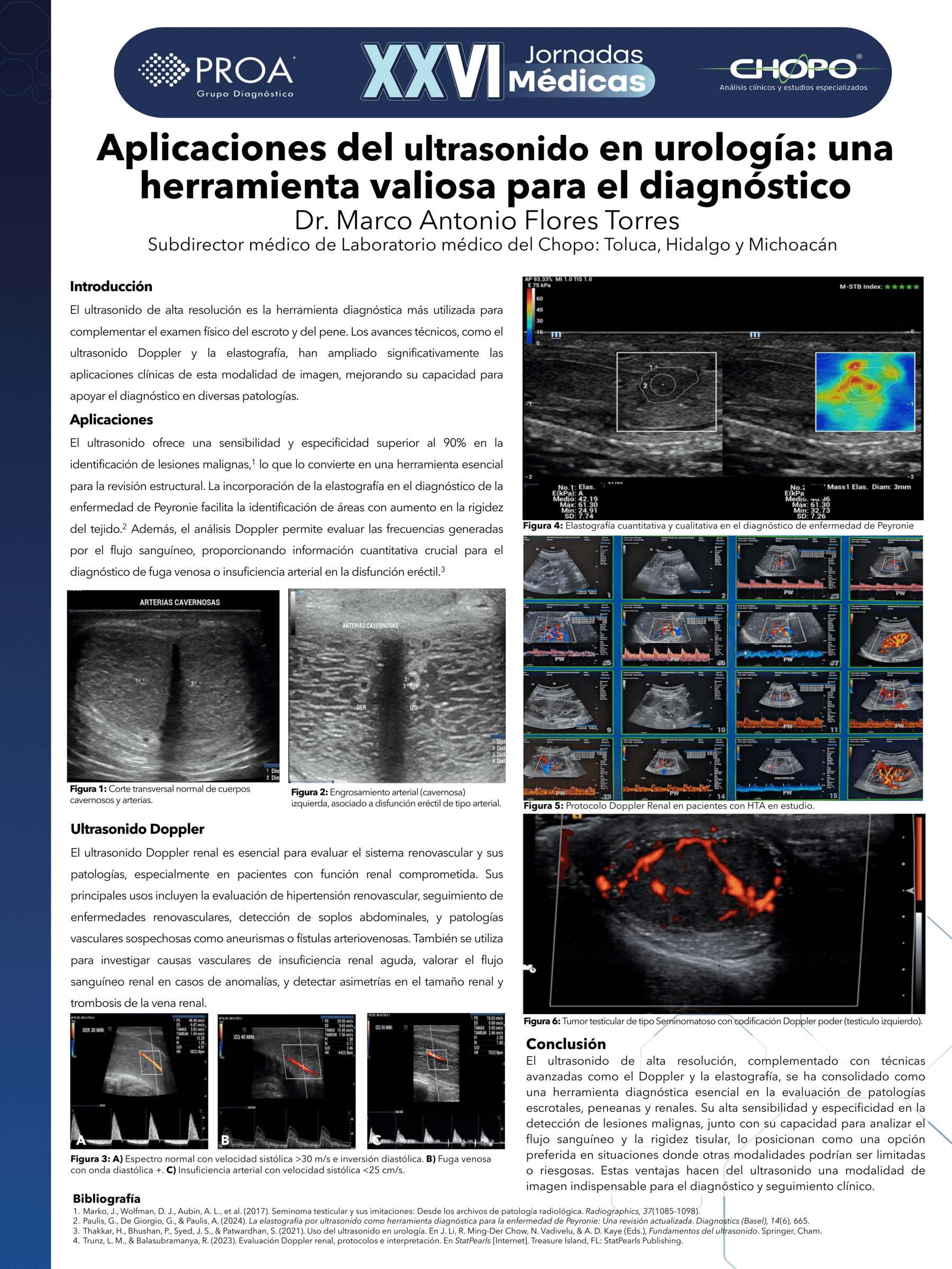 Aplicaciones del ultrasonido en urología: una herramienta valiosa para el diagnóstico