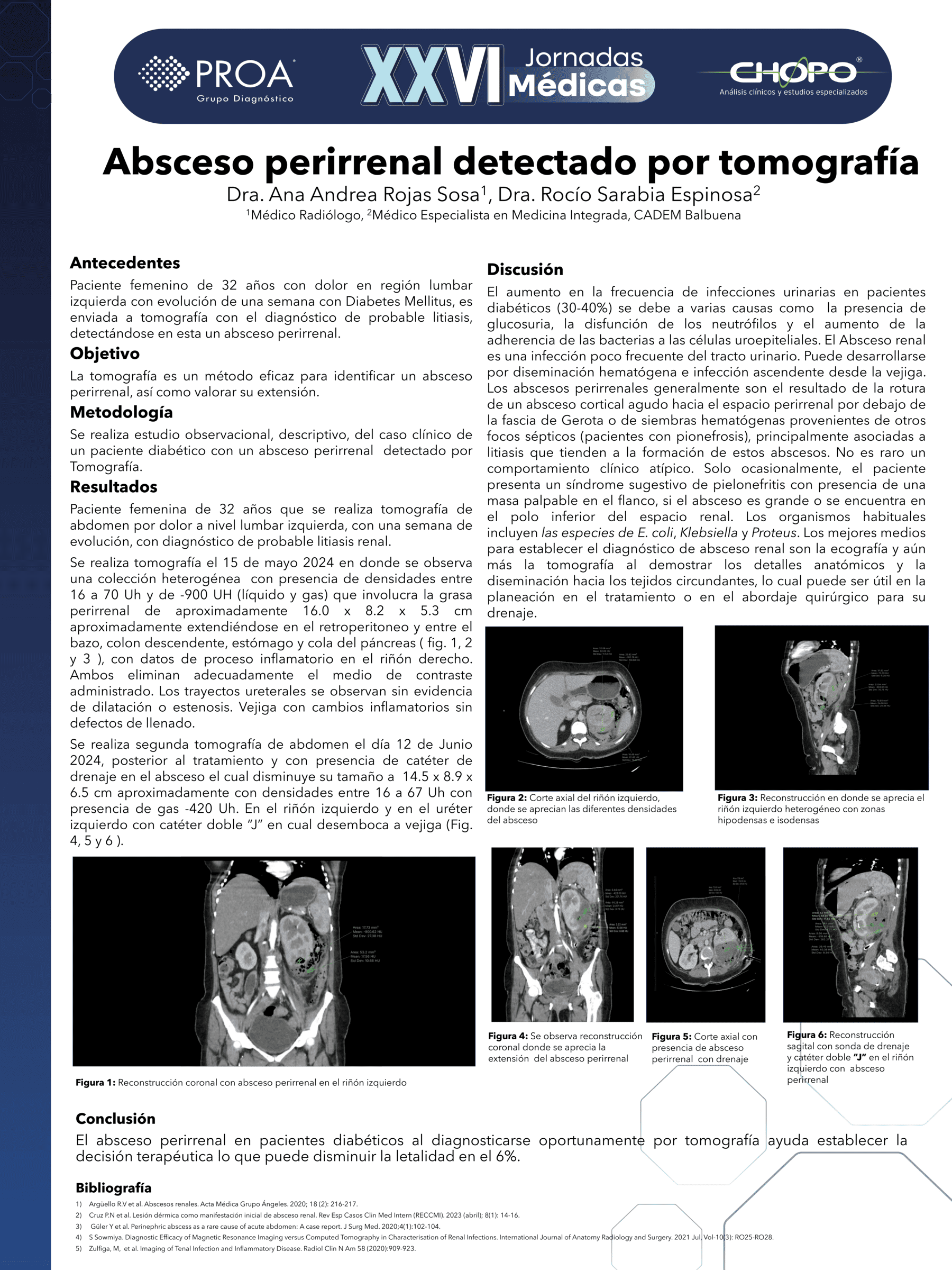 Absceso perirrenal detectado por tomografía