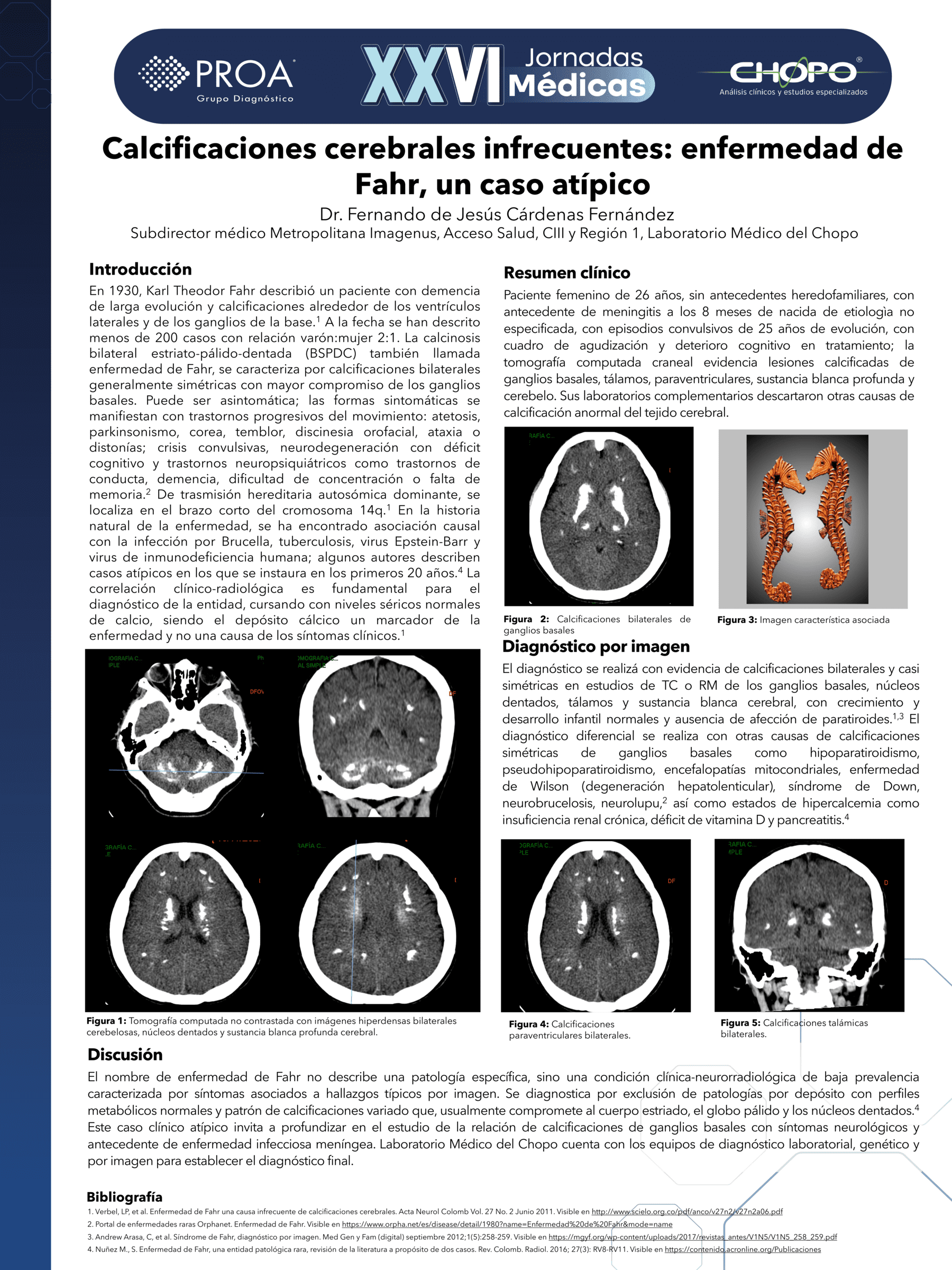 Calcificaciones cerebrales infrecuentes: enfermedad de Fahr, un caso atípico