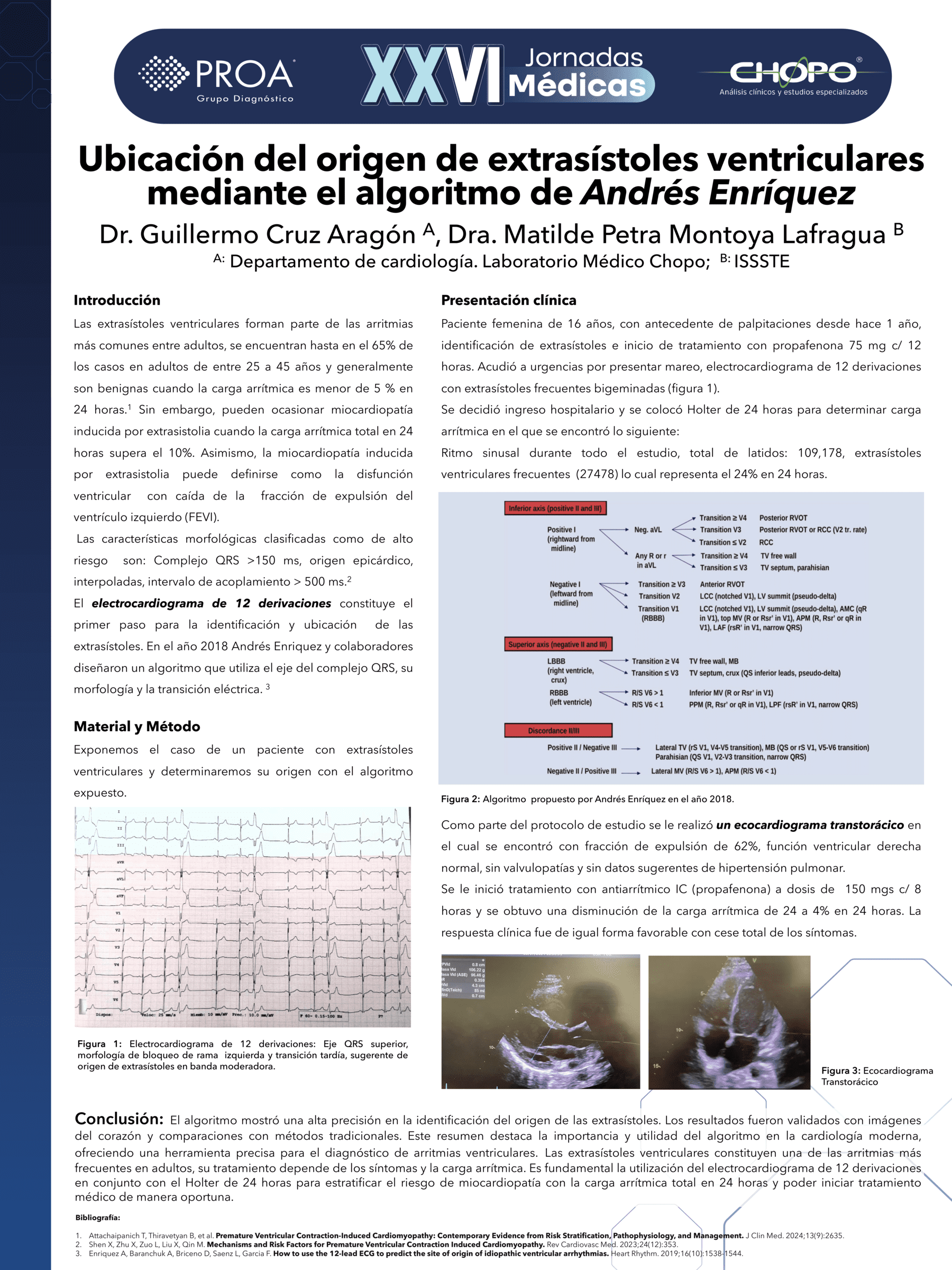 Ubicación del origen de extrasístoles ventricularesmediante el algoritmo de Andrés Enríquez