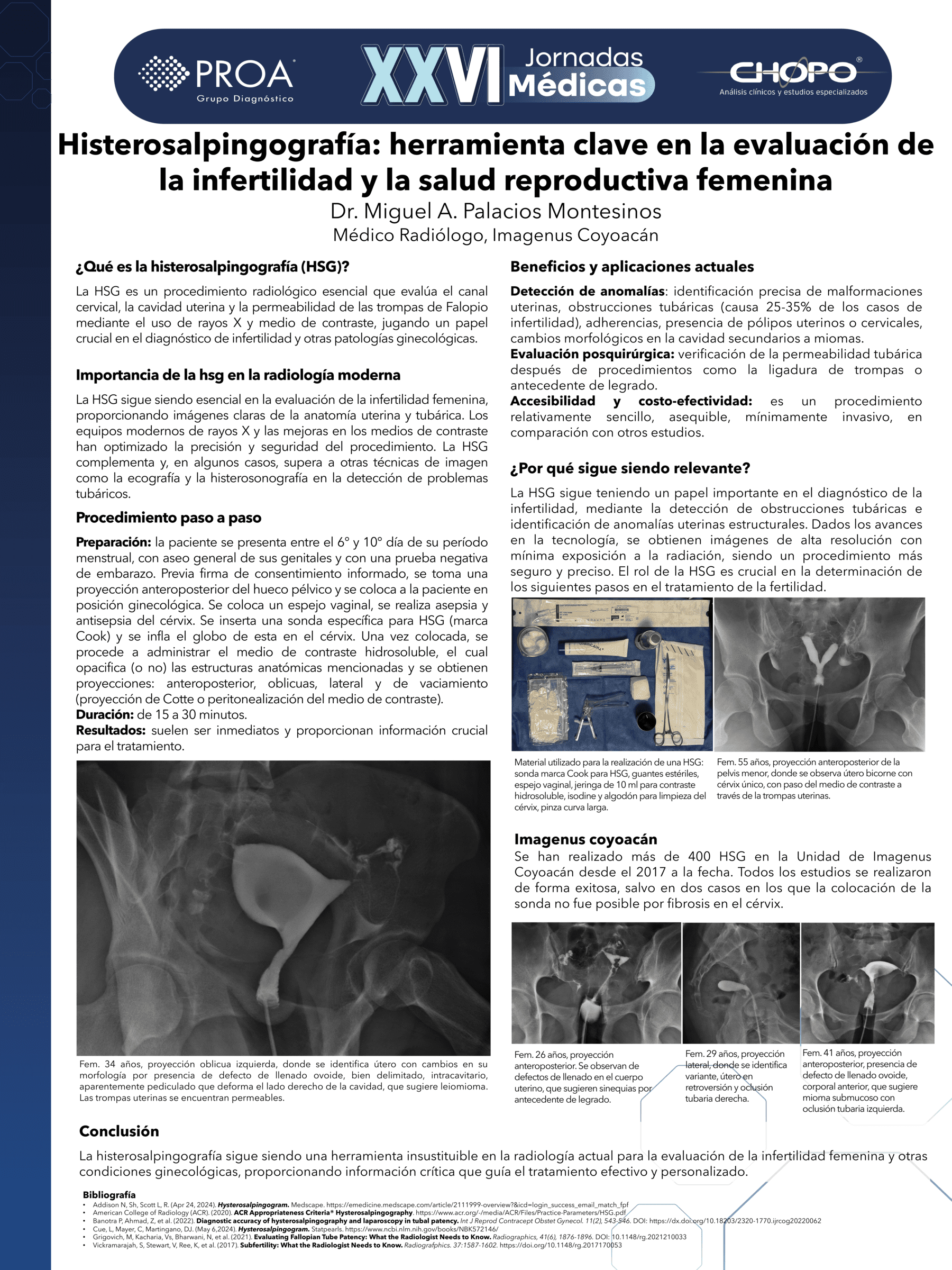 Histerosalpingografía: herramienta clave en la evaluación de la infertilidad y la salud reproductiva femenina