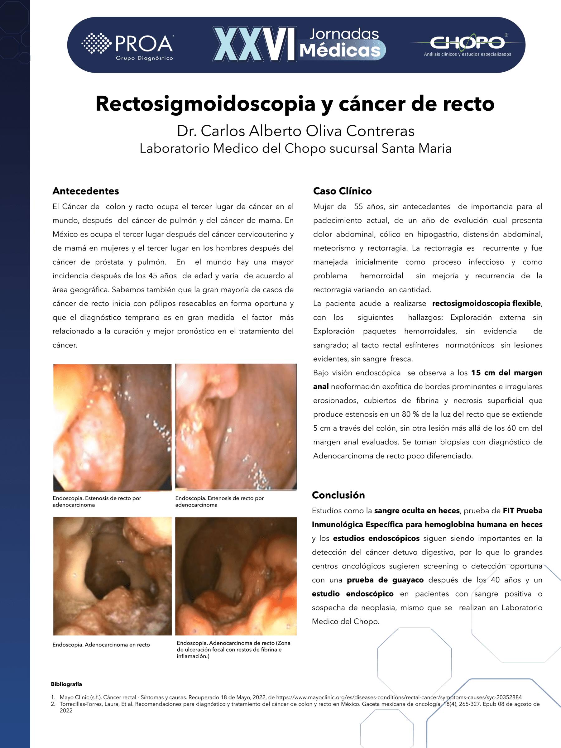 Rectosigmoidoscopia y cáncer de recto